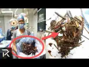 Video: BIZARRE THINGS DISCOVERED Inside People